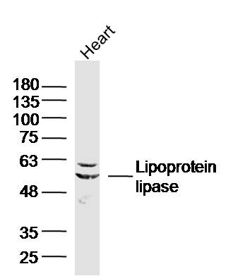 Anti-Lipoprotein lipase Polyclonal Antibody