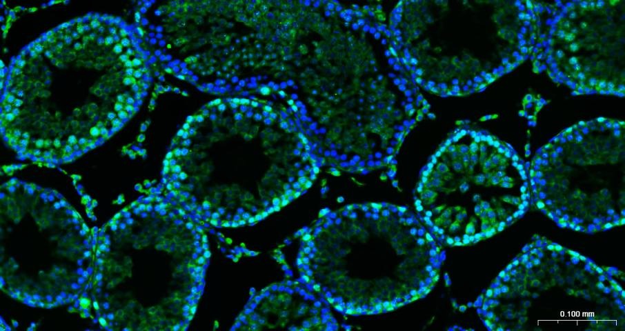 Anti-MKI67 Antibody (3A821)