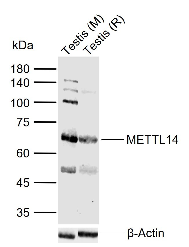 Anti-METTL14 Polyclonal Antibody
