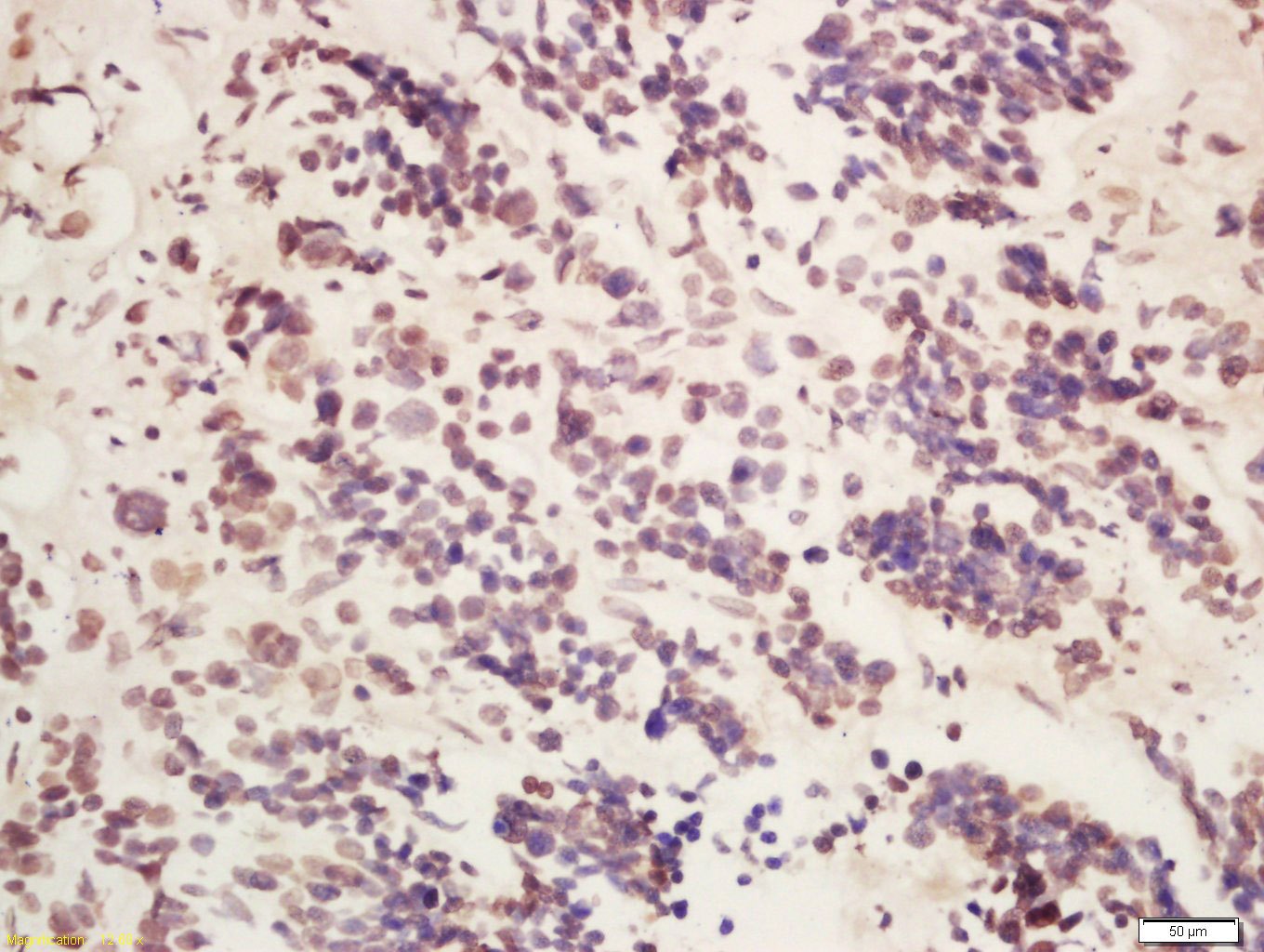 Anti-METTL14 Polyclonal Antibody