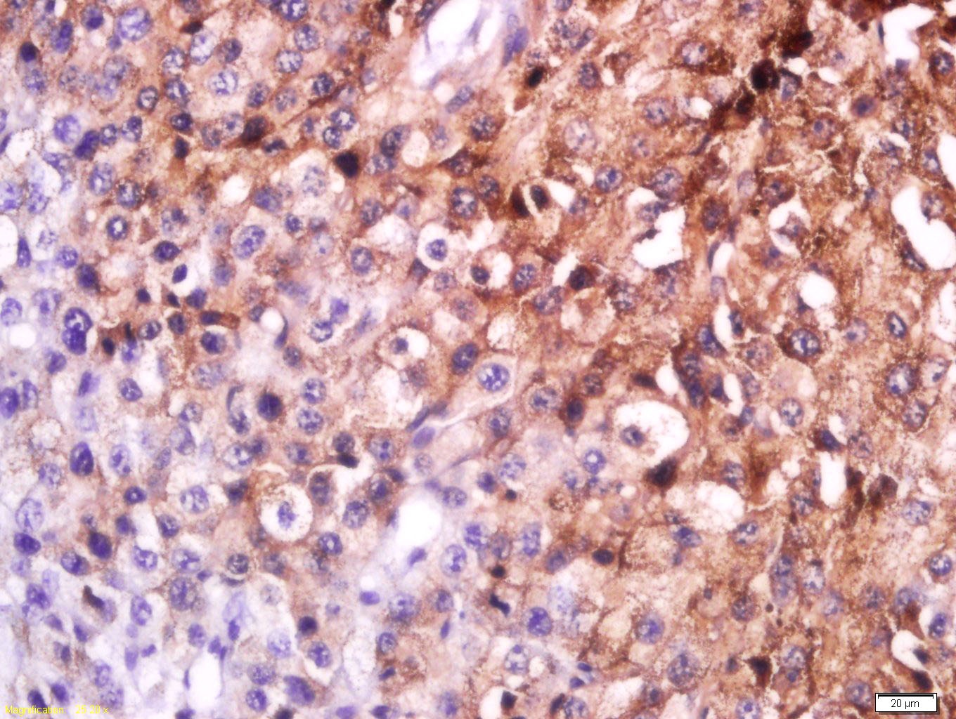 Anti-MC1R Polyclonal Antibody