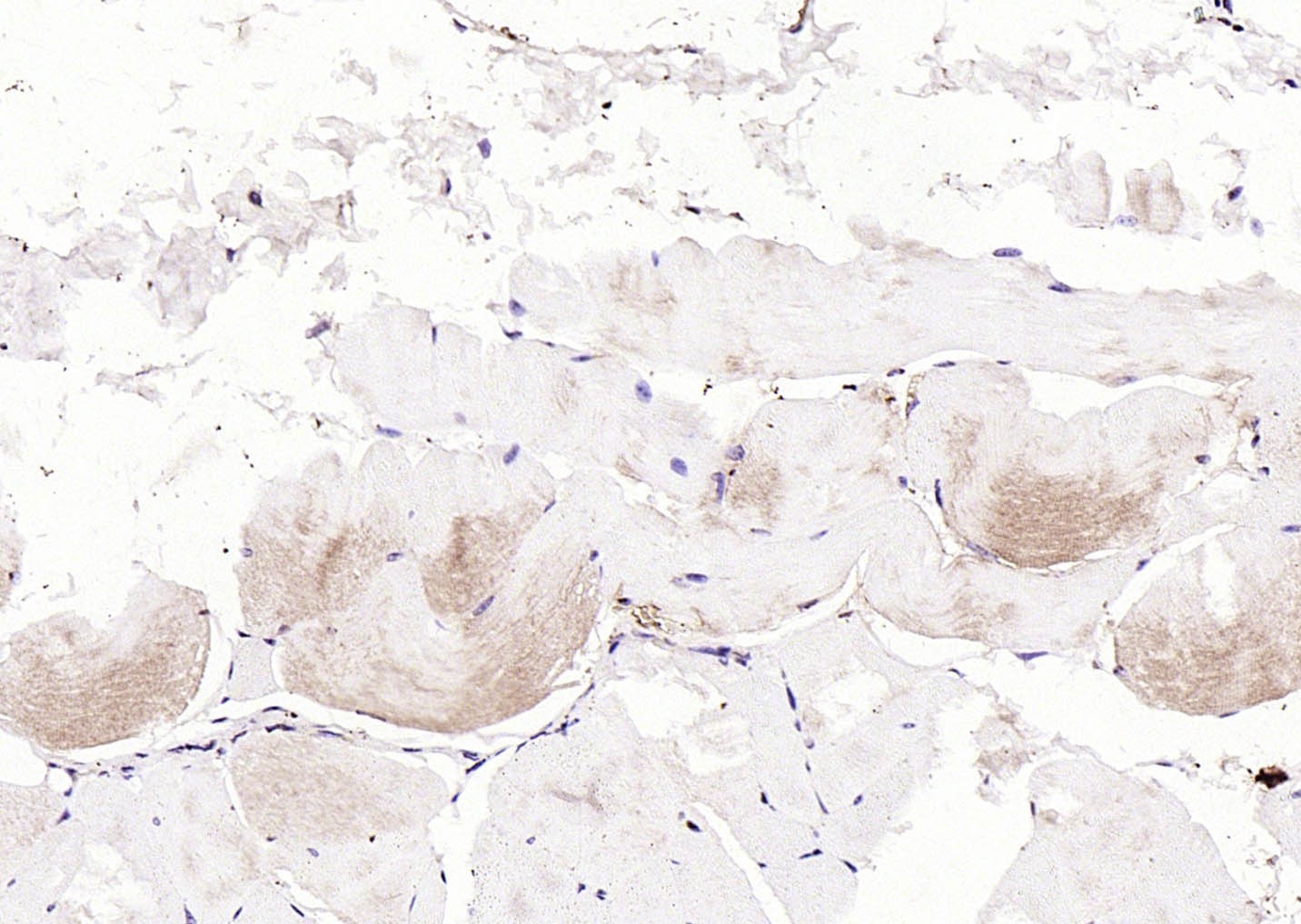 Anti-LATS2 Polyclonal Antibody