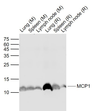 Anti-MCP-1/CCL2 Polyclonal Antibody 2
