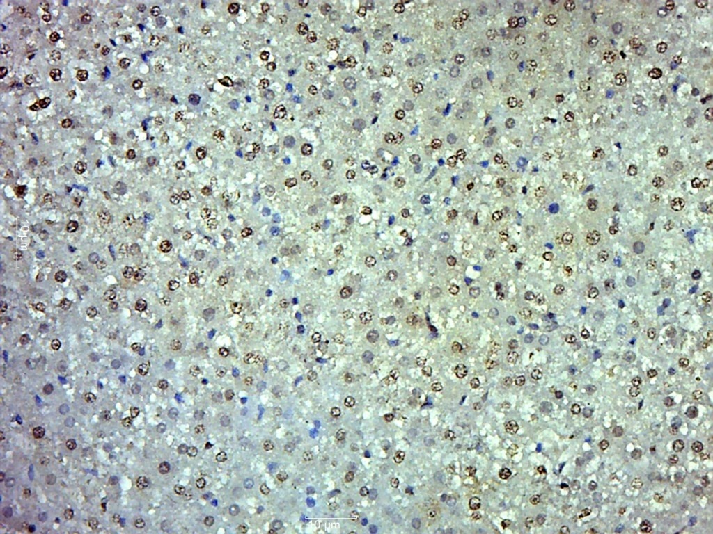 Anti-Lp-PLA2/PLA2G7 Polyclonal Antibody