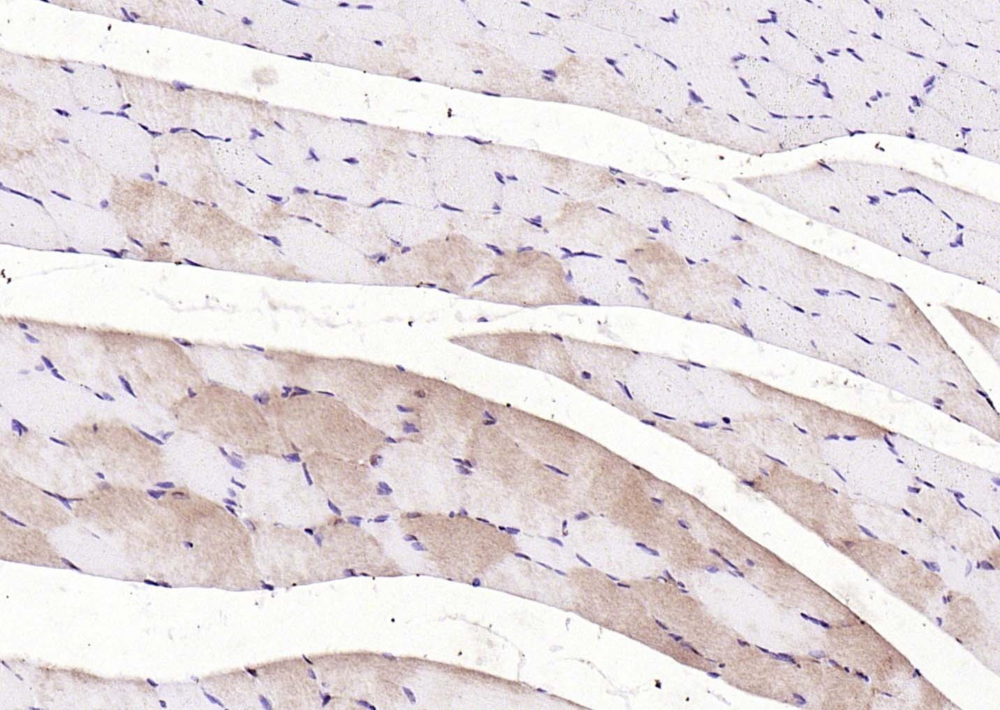 Anti-LATS2 Polyclonal Antibody