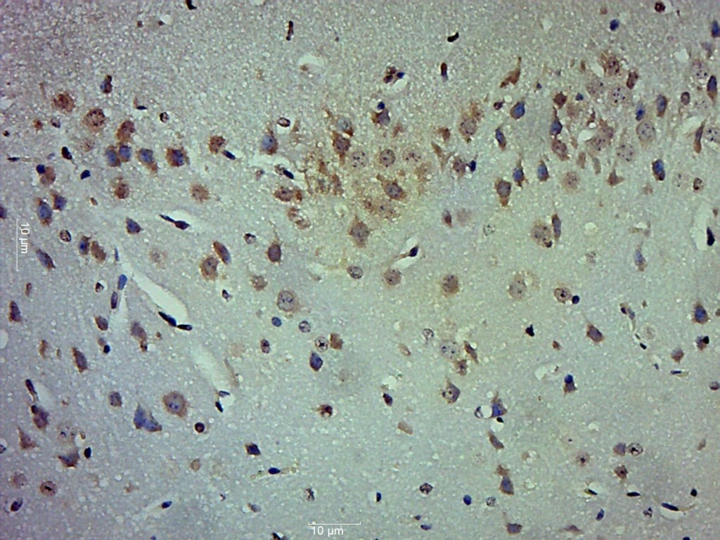 Anti-LOX-1 Polyclonal Antibody