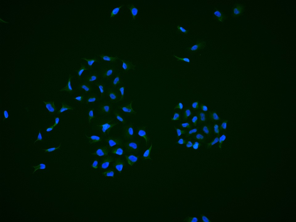 Anti-LATS1 Polyclonal Antibody