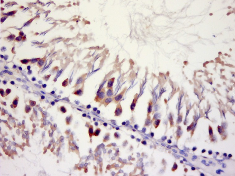Anti-MCU Polyclonal Antibody