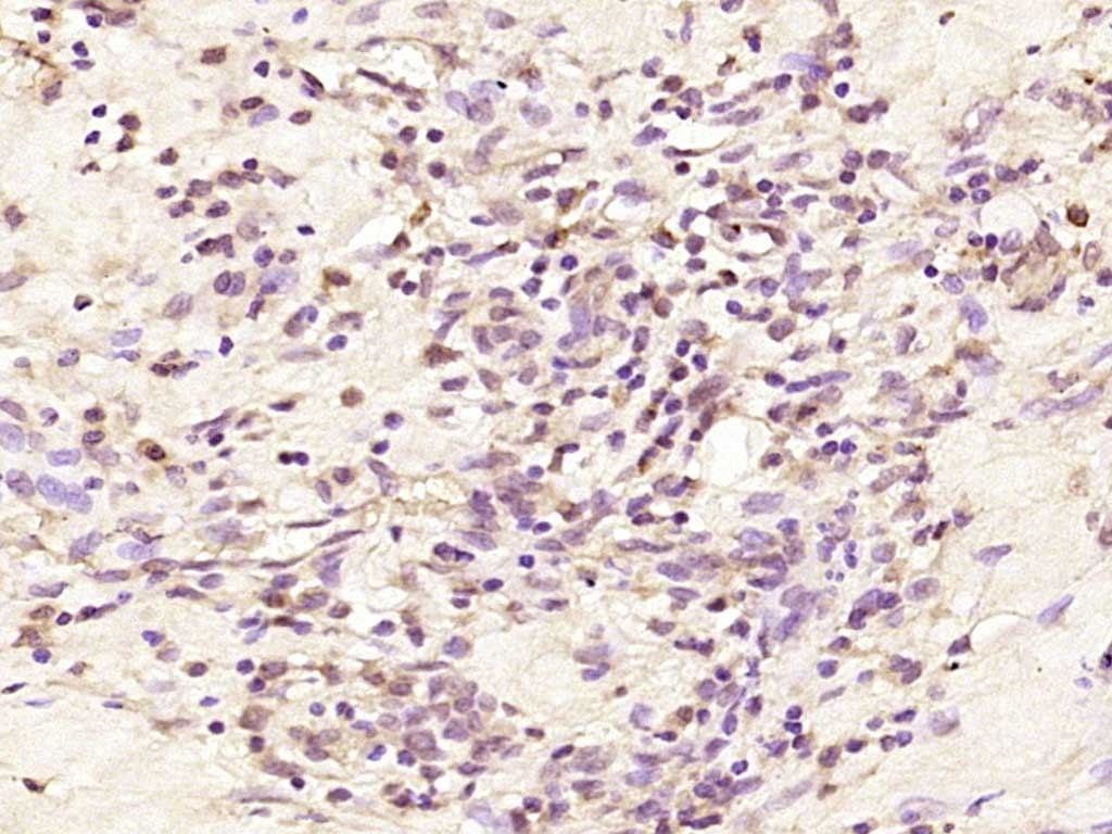 Anti-LOR/Loricrin Polyclonal Antibody