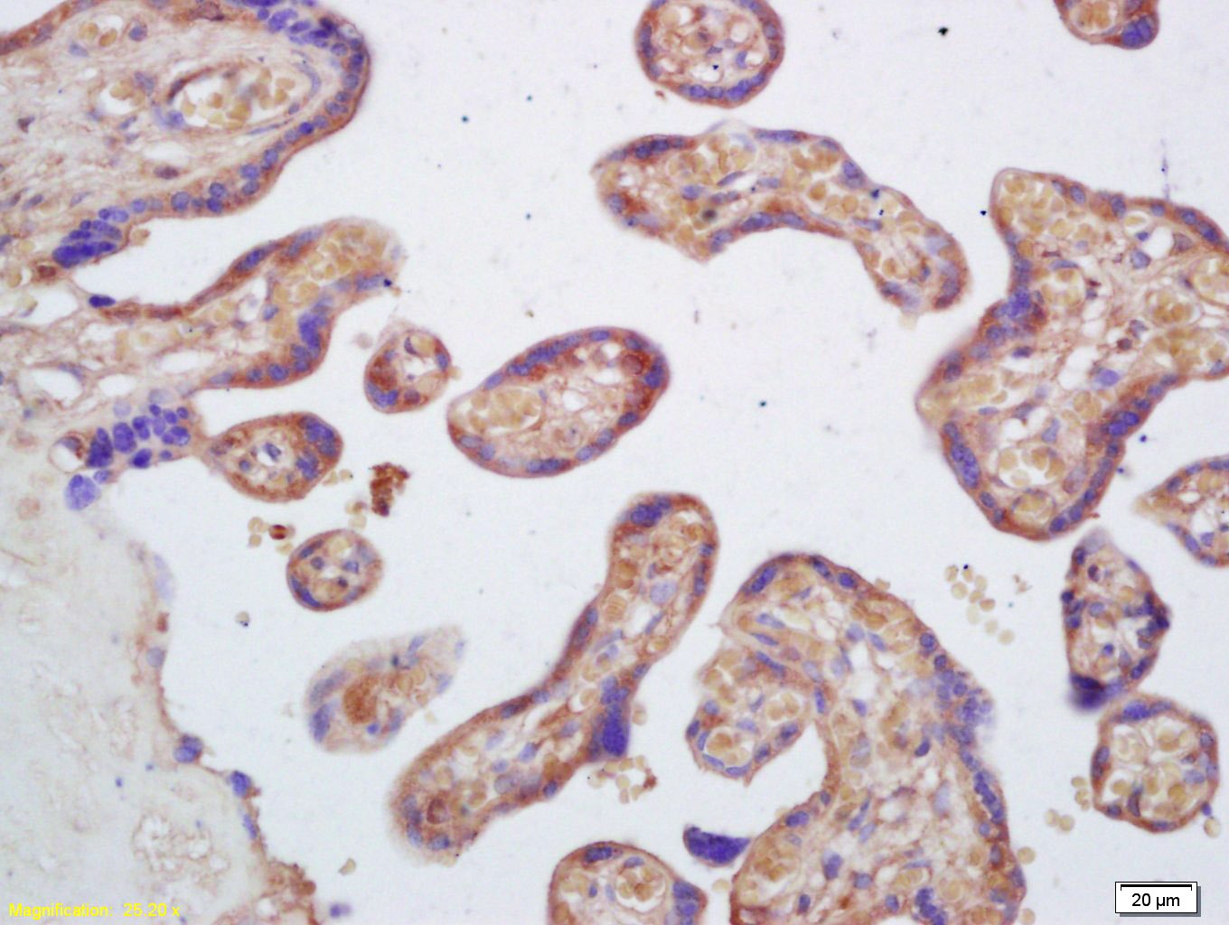 Anti-Lp-PLA2/PLA2G7 Polyclonal Antibody