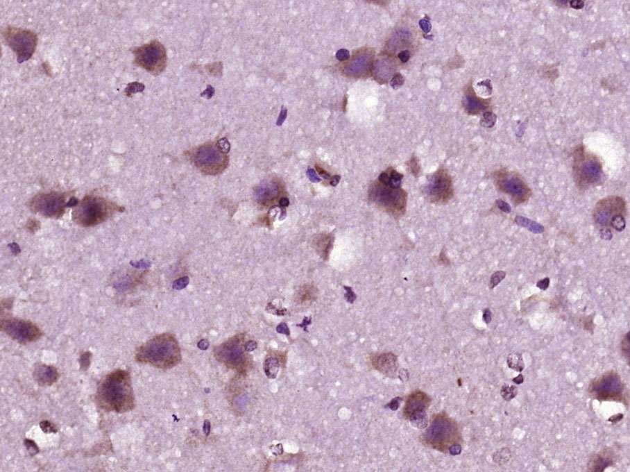 Anti-LOX-1 Polyclonal Antibody