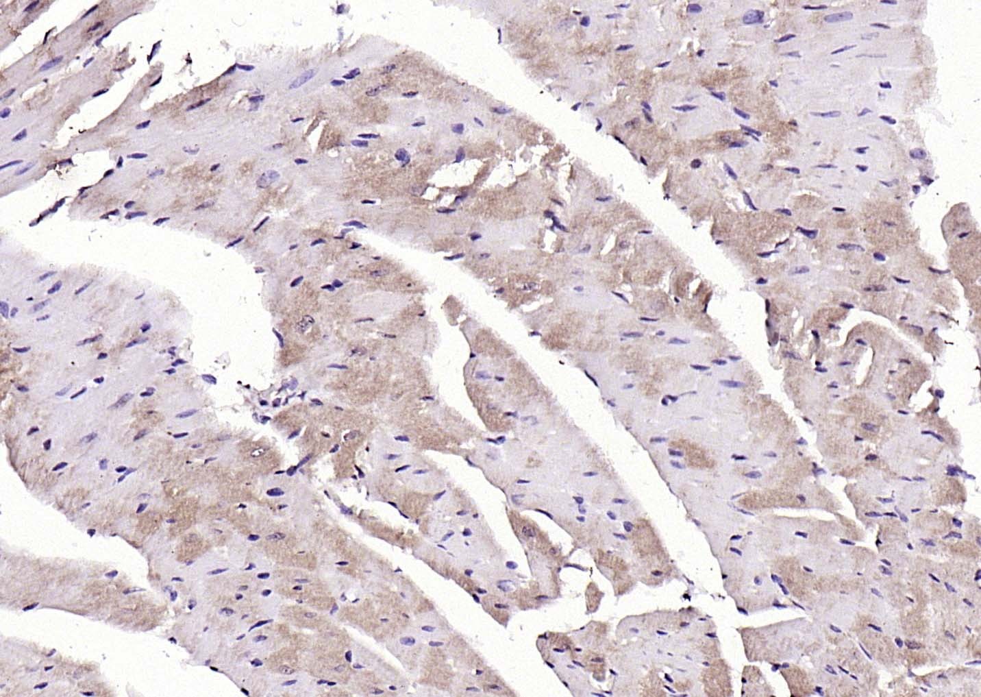 Anti-LATS2 Polyclonal Antibody