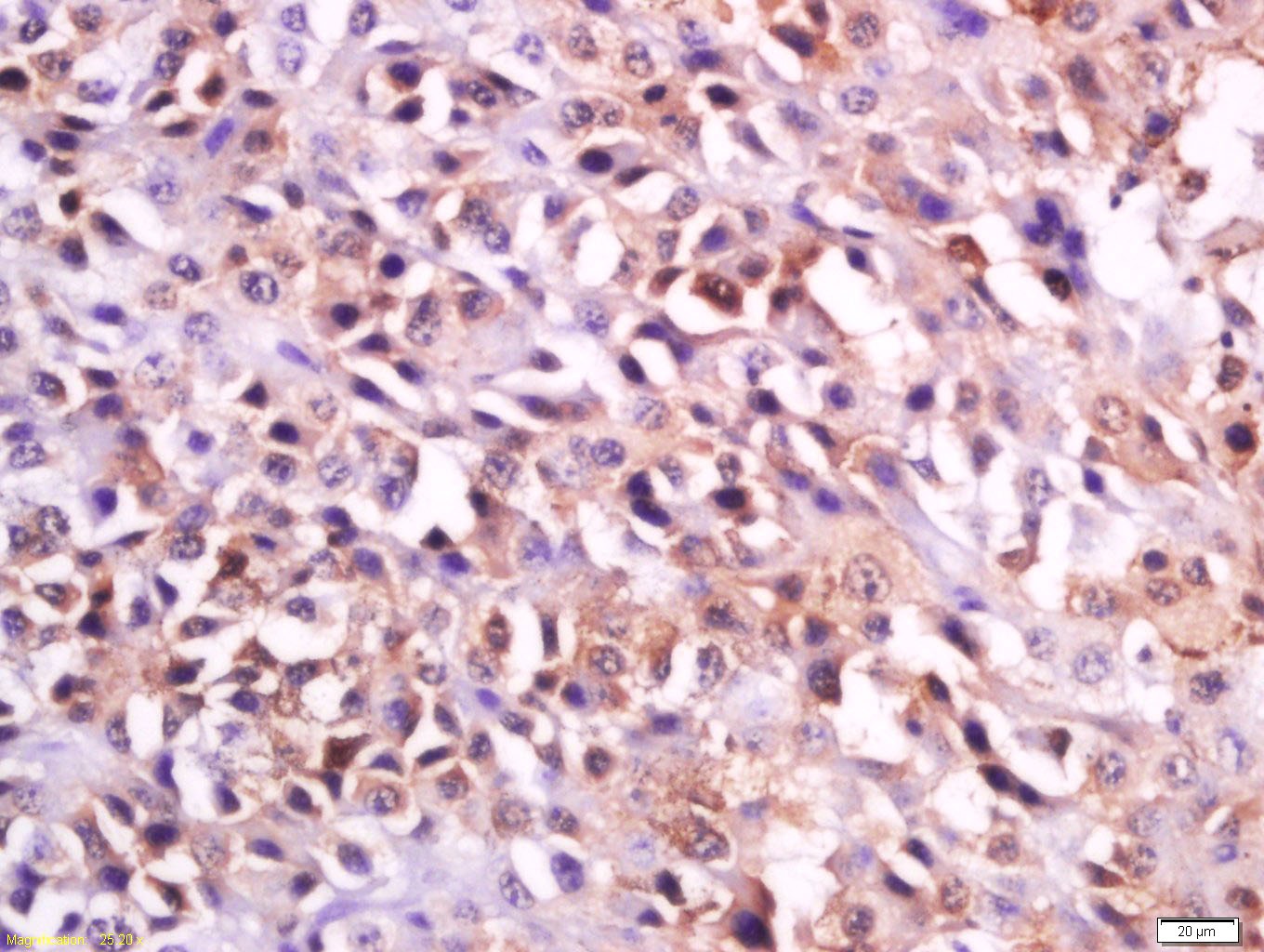 Anti-MC1R Polyclonal Antibody