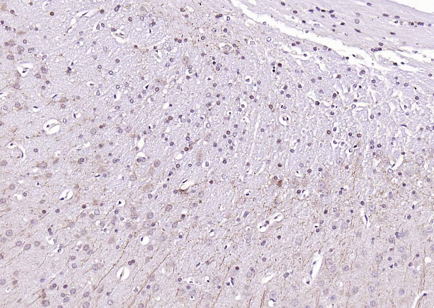 Anti-LATS2 Polyclonal Antibody