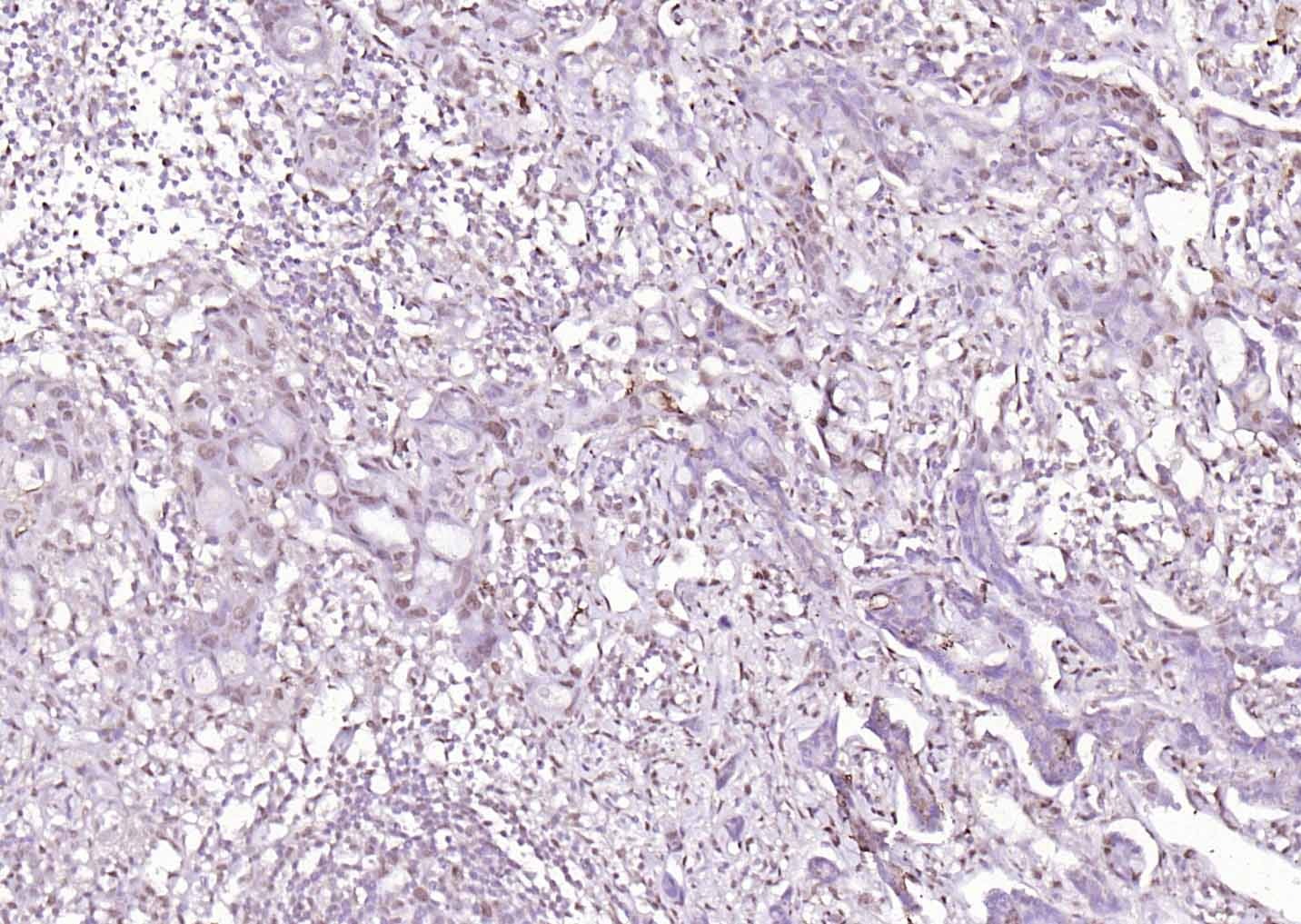 Anti-LATS2 Polyclonal Antibody