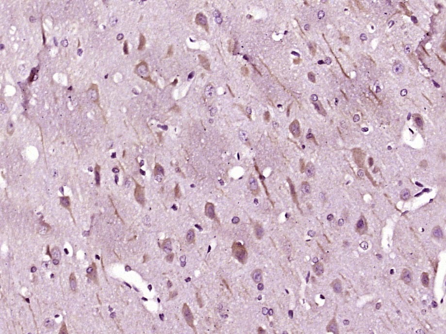 Anti-LC3B Polyclonal Antibody