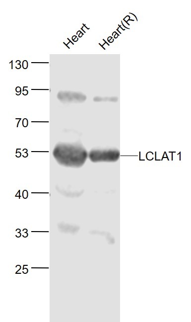 Anti-LCLAT1 Polyclonal Antibody