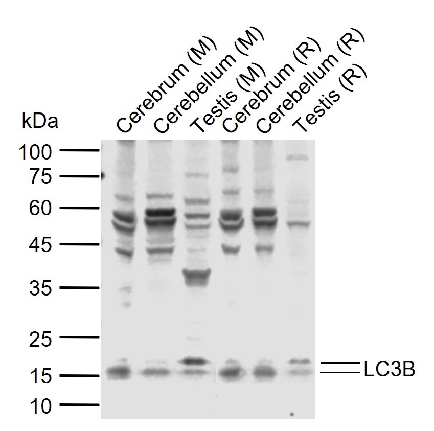 Anti-LC3B Polyclonal Antibody 2