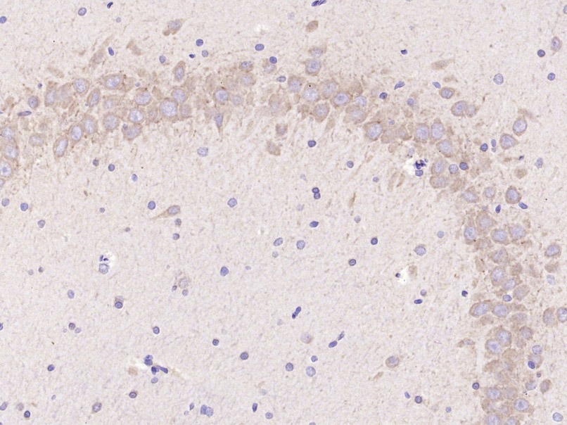 Anti-LC3B Polyclonal Antibody