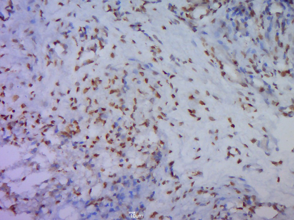 Anti-Phospho-GSK3B (Ser9) Polyclonal Antibody