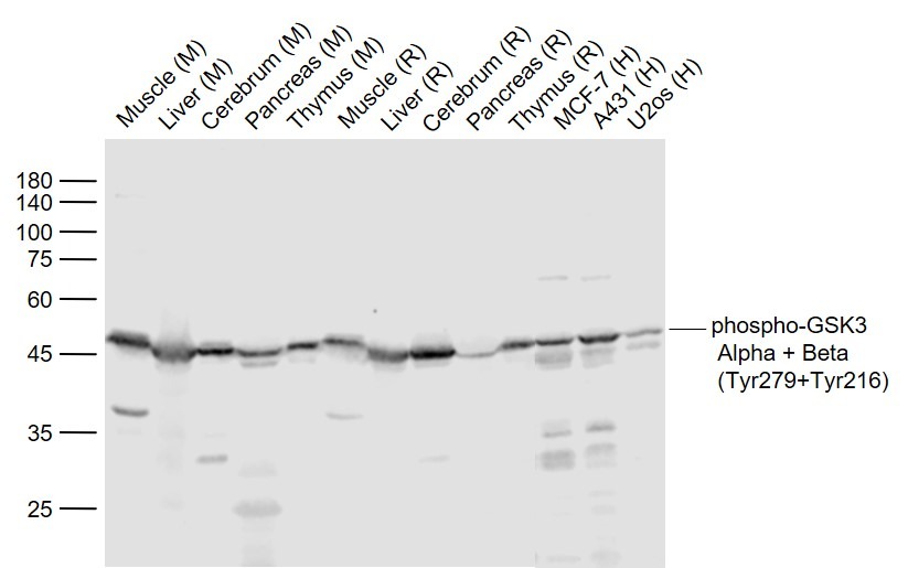 Anti-Phospho-GSK3B (Tyr216) Polyclonal Antibody