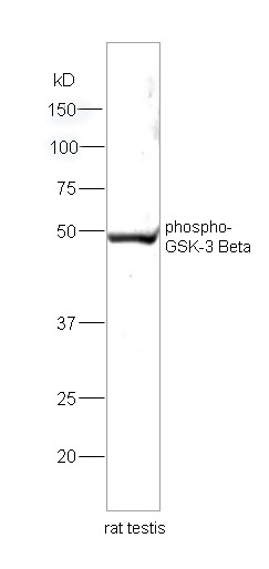 Anti-Phospho-GSK3B (Ser9) Polyclonal Antibody