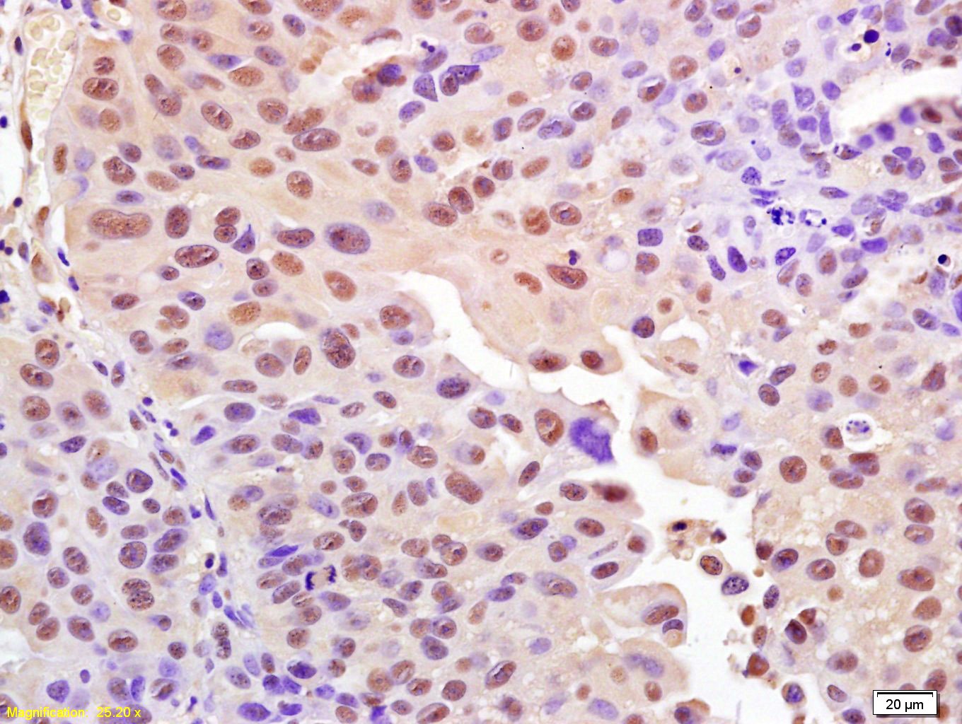 Anti-Phospho-H2AFX (Ser139) Polyclonal Antibody