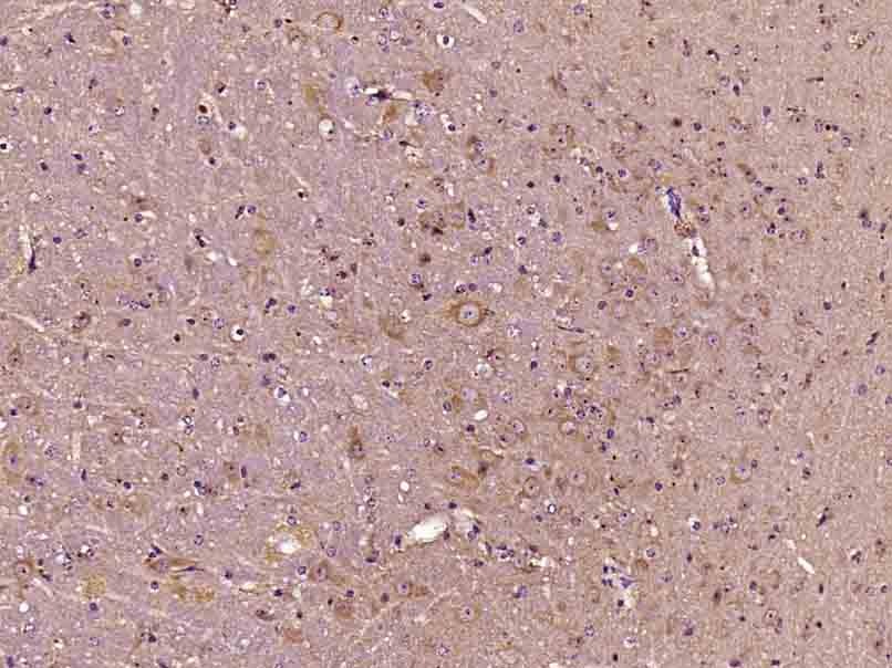 Anti-Phospho-AKT1 (Thr34) Polyclonal Antibody