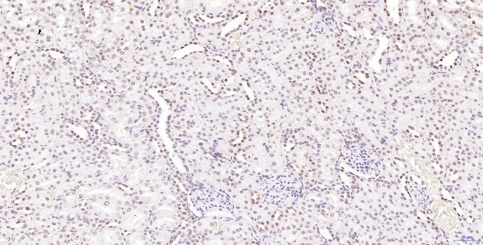 Anti-Phospho-H2AFX (Ser139) Antibody (2T270)