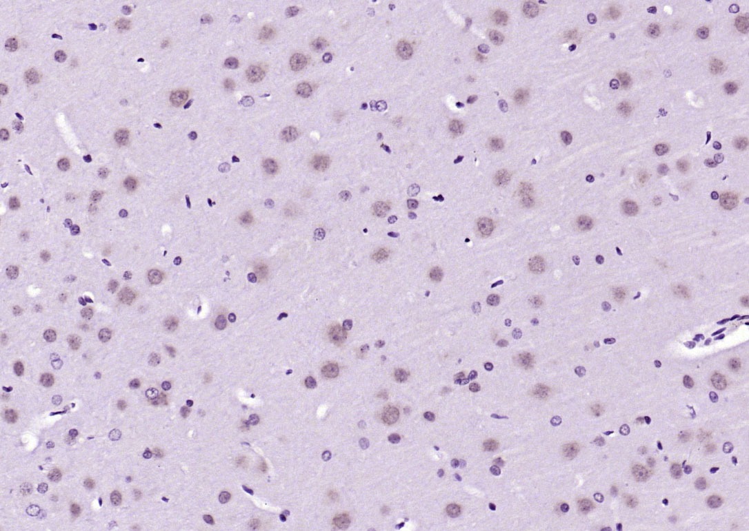 Anti-Phospho-AKT3 (Ser472) Polyclonal Antibody