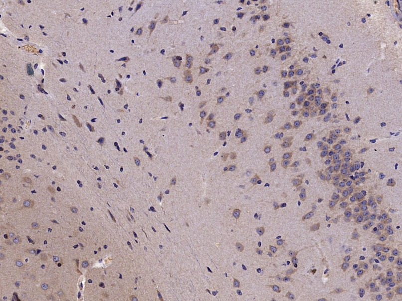 Anti-Phospho-HMGCR (Ser872) Polyclonal Antibody
