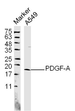 Anti-PDGF-AA Polyclonal Antibody