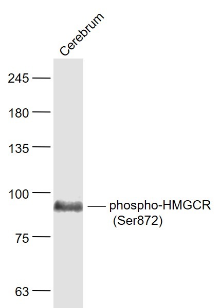 Anti-Phospho-HMGCR (Ser872) Polyclonal Antibody