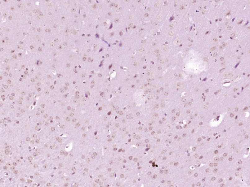 Anti-Phospho-AKT3 (Ser472) Polyclonal Antibody
