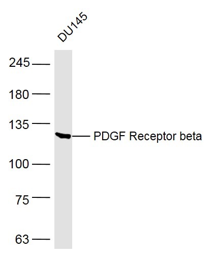 Anti-PDGF R beta/CD140b Polyclonal Antibody
