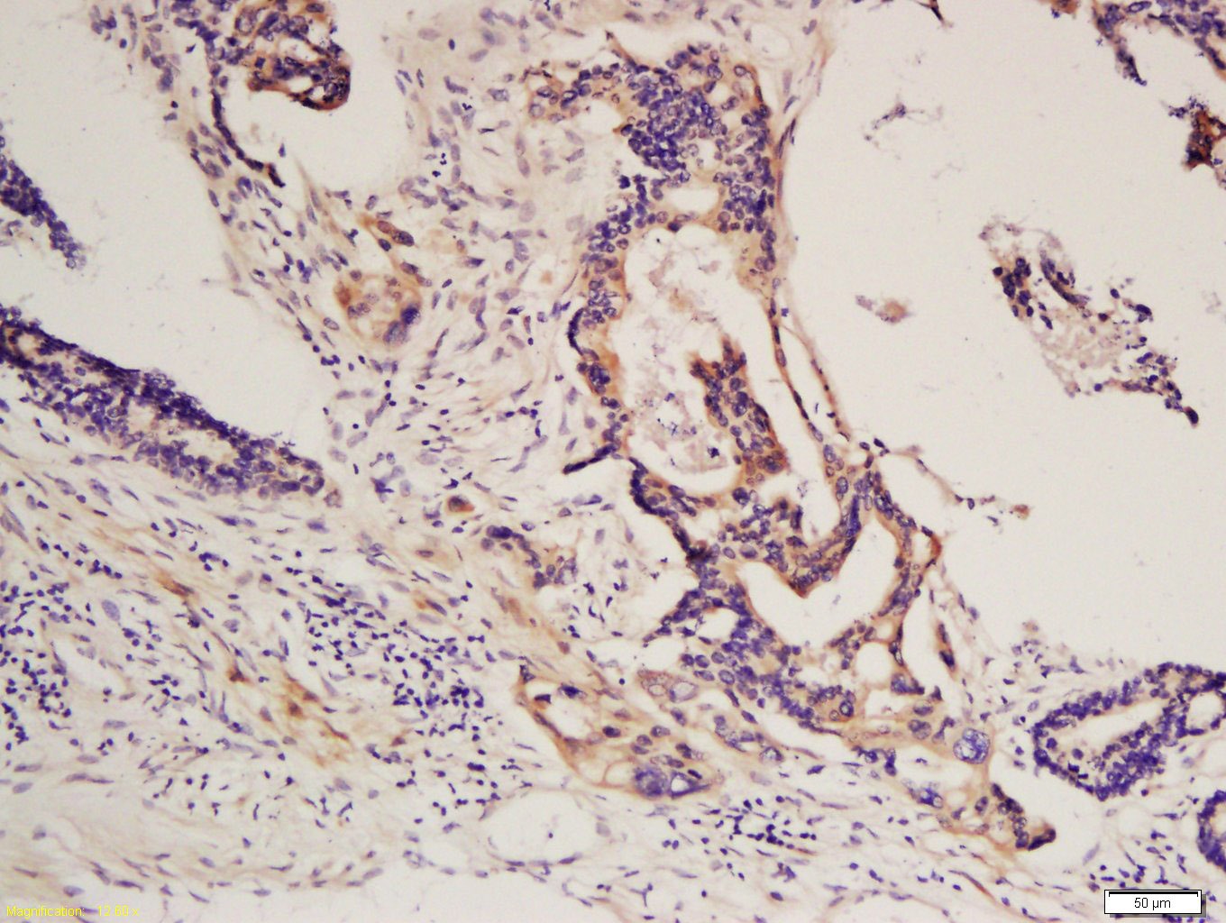 Anti-PDGFRA Polyclonal Antibody