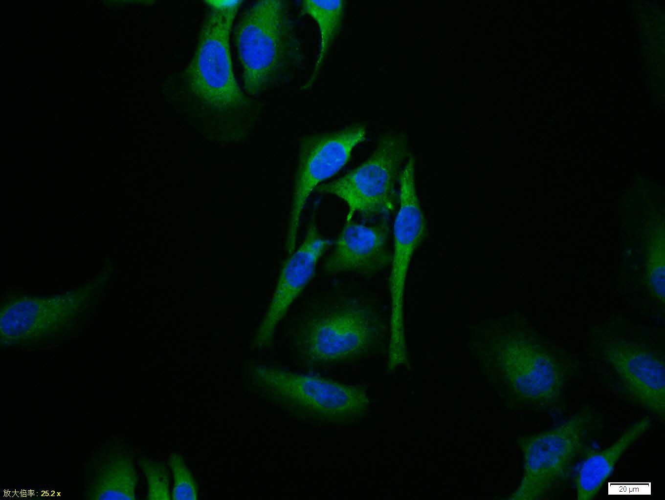 Anti-Phospho-IkB alpha/NFKBIA (Ser32) Polyclonal Antibody