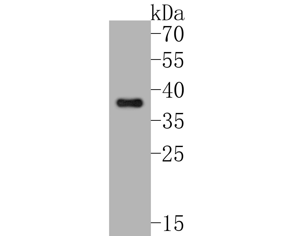 Anti-Phospho-IkB alpha/NFKBIA (Ser32) Antibody (7N349)