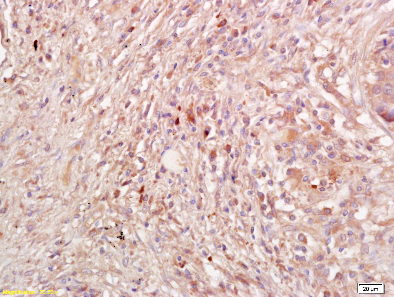 Anti-PDCD6IP Polyclonal Antibody