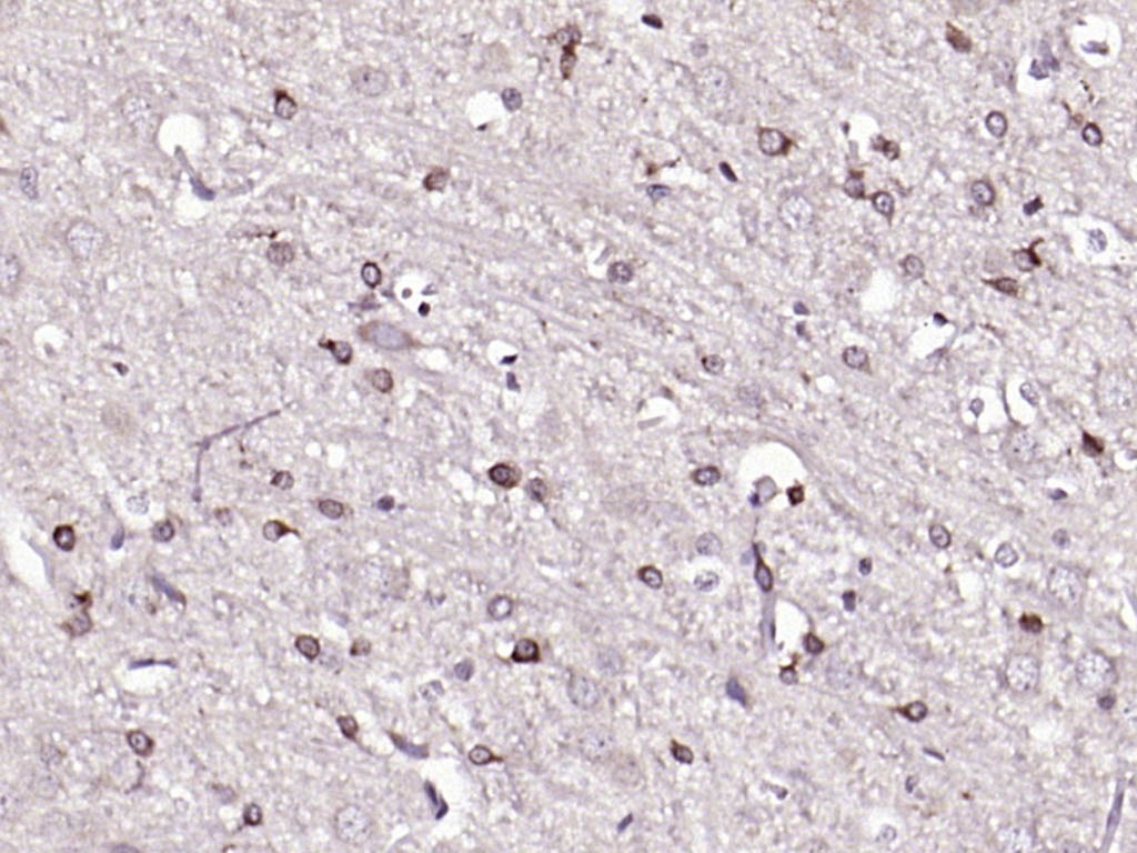 Anti-Phospho-HMGCR (Ser872) Polyclonal Antibody