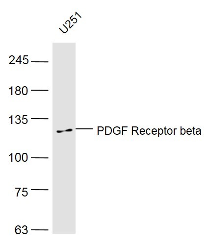 Anti-PDGF R beta/CD140b Polyclonal Antibody