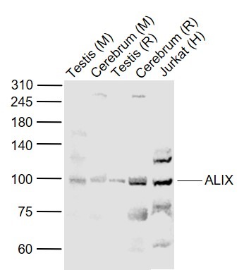 Anti-PDCD6IP Polyclonal Antibody
