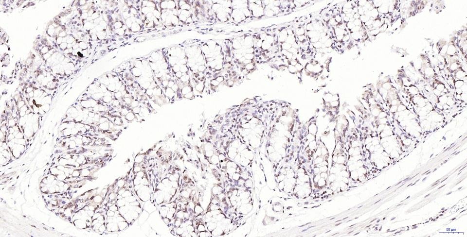 Anti-Phospho-H2AFX (Ser139) Antibody (2T270)
