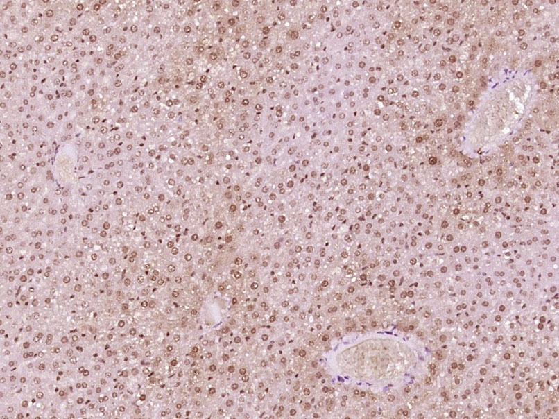Anti-Phospho-AMPK alpha 1/2 (Thr183, 172) Polyclonal Antibody