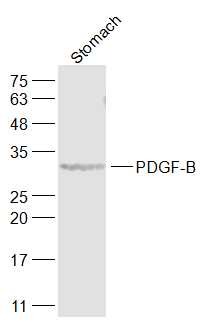 Anti-PDGF-BB Polyclonal Antibody
