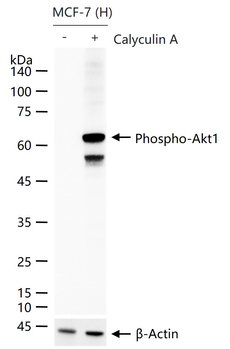 Anti-Phospho-AKT1 (Ser473) Antibody (8N918)