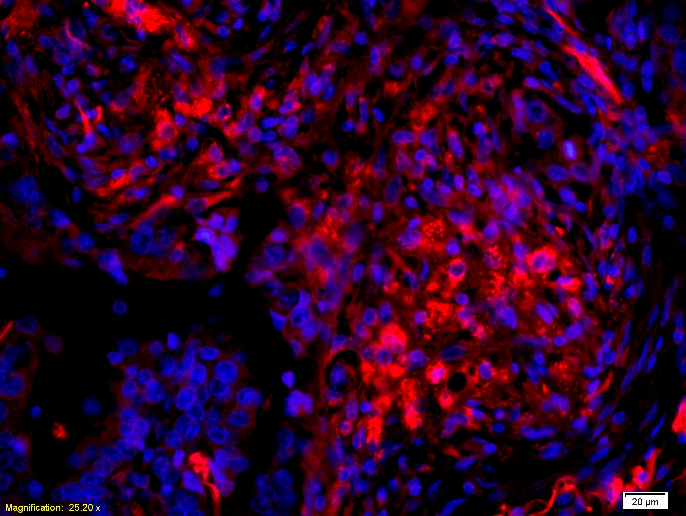 Anti-Phospho-AKT3 (Ser472) Polyclonal Antibody