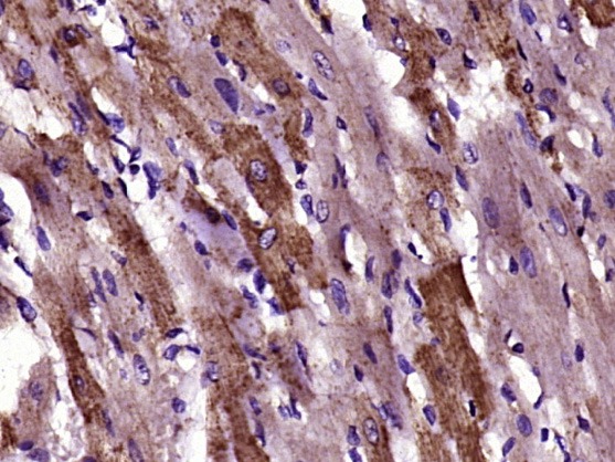 Anti-PDHA1 Polyclonal Antibody