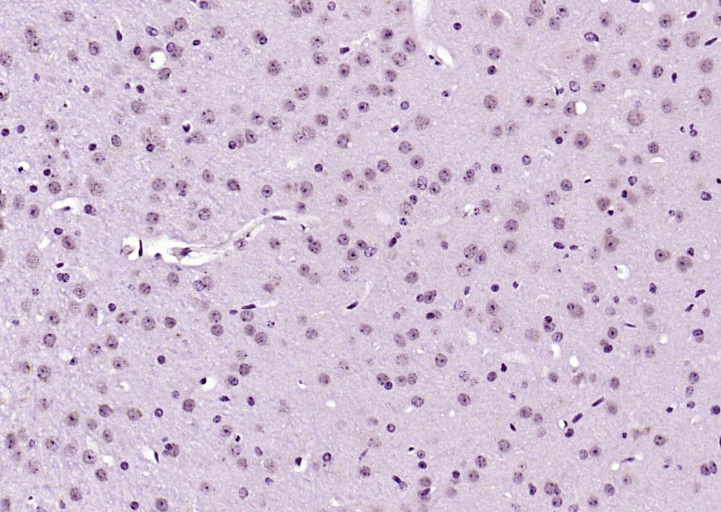 Anti-Phospho-AKT3 (Ser472) Polyclonal Antibody