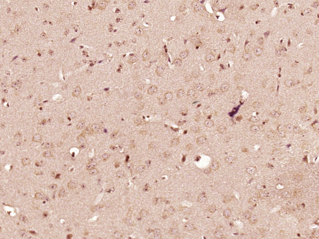 Anti-PDGF-BB Polyclonal Antibody 2
